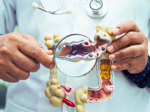 Sangue oculto nas fezes: que exame é esse? 