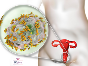 Vaginose bacteriana: entenda a condição mais comum entre as mulheres