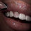 Thumbnail: I Heart Tooth Gem Kit