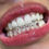 Thumbnail: Twinkle Twinkle Tooth Gem Kit