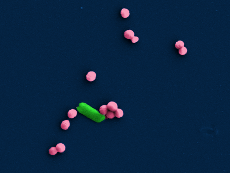 Scientists develop device to detect bacteria in minutes
