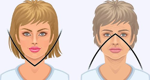 v face treatment kl