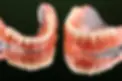removable-nylon-dentures.webp