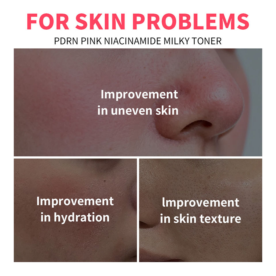 Thumbnail: PDRN Pink Niacinamide Milky Toner for Hydrating Moisturizing Soothing Ceramide G