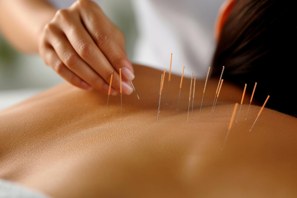 Terapias complementares: acupuntura ajuda nos tratamentos de fertilidade?