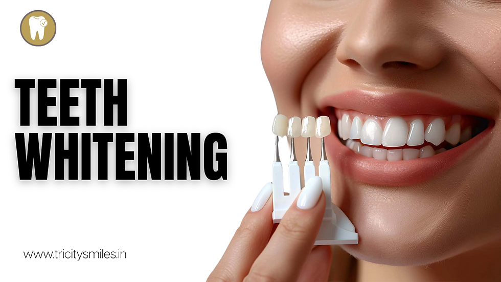 Brighten Your Smile Safely: A Guide to Professional Tooth Whitening