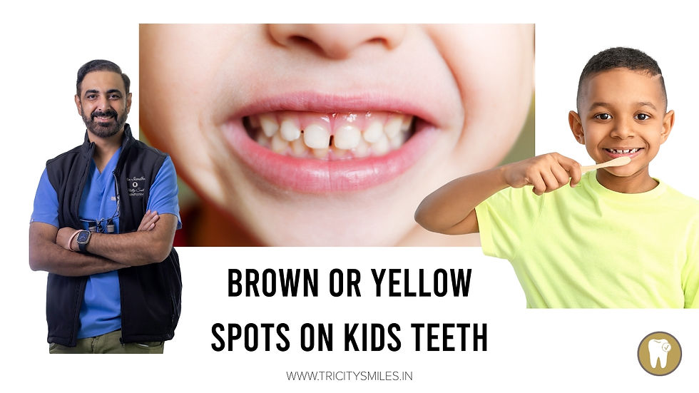 Yellow or Brown Discoloration of Your Child’s Teeth? Here’s What They Really Mean (and How to Fix Them)