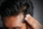 caĆda del cabello
