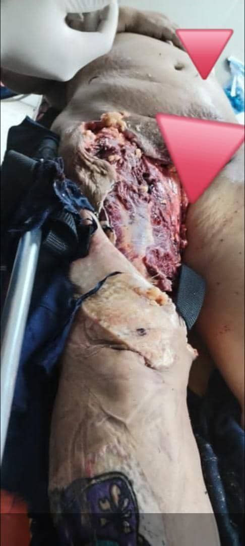 Aparatoso accidente de tránsito en la autopista Caracas-La Guaira deja dos heridos.