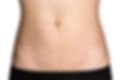 stretch-marks-7.jpg