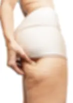Cellulite 3.webp