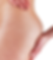 Stretch Marks 3.png