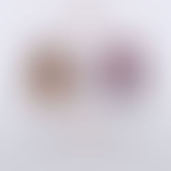 HR + HER2 - Metastatik Meme Ca’da Tedaviler