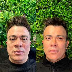 Metamorphose Full Face