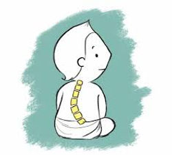 Early Onset Scoliosis