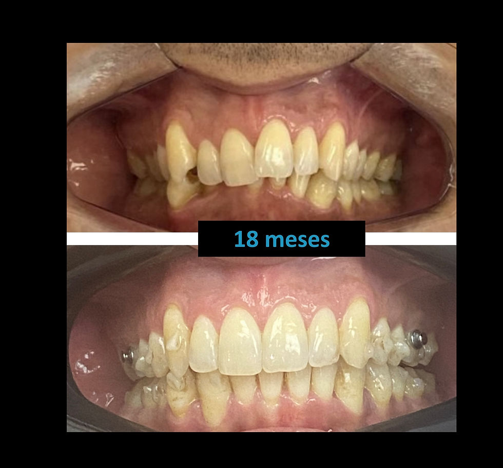 final 18 meses 2