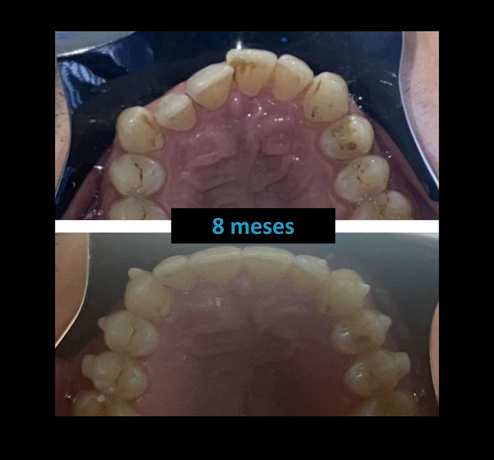 final 8 meses.png