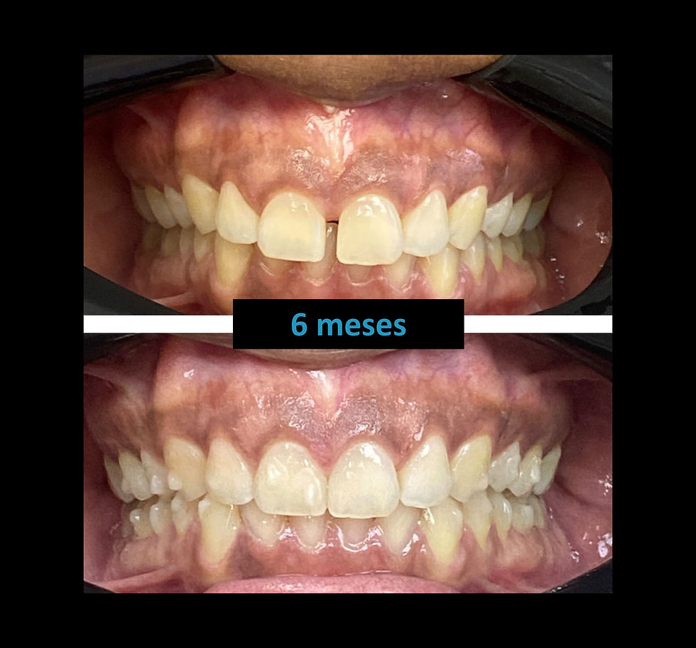 final 6 meses 2