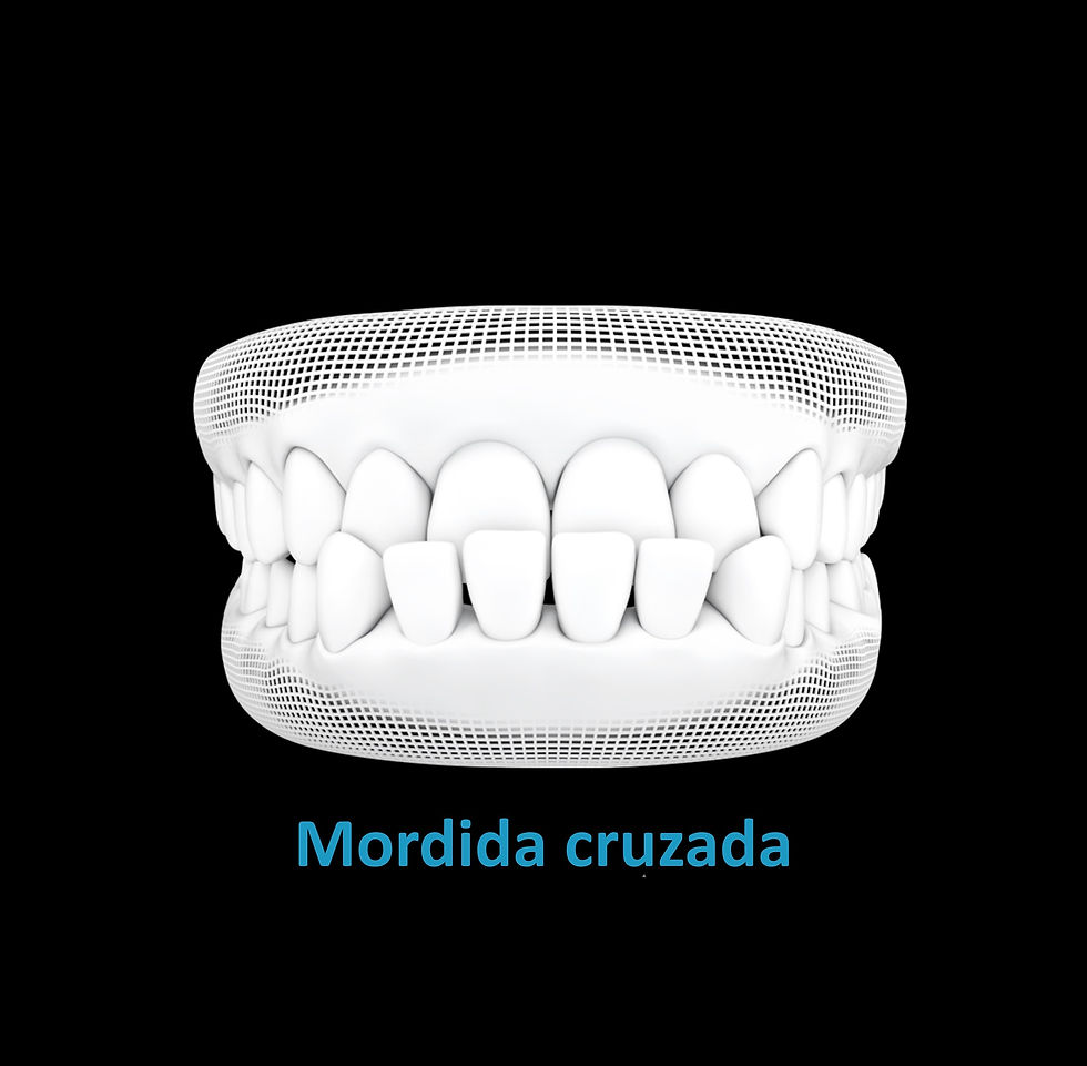Mordida Cruzada