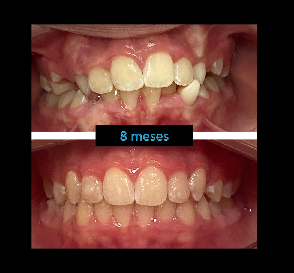 final 8 meses 3