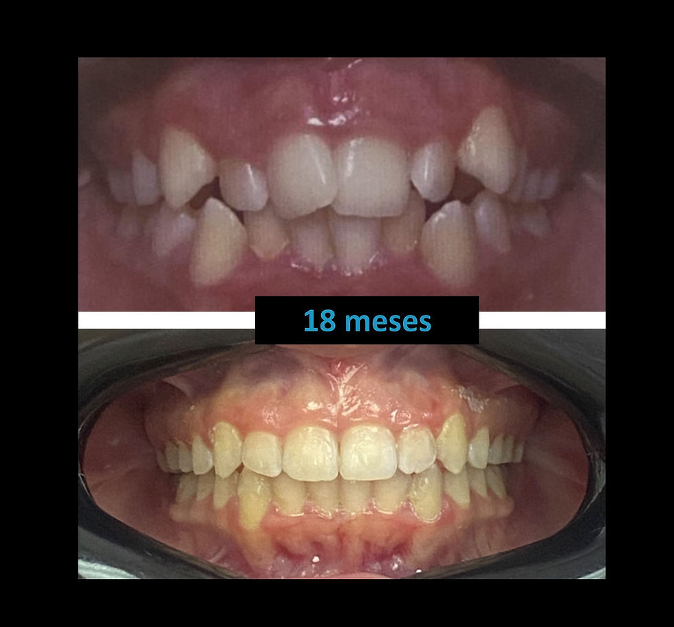 final 18 meses