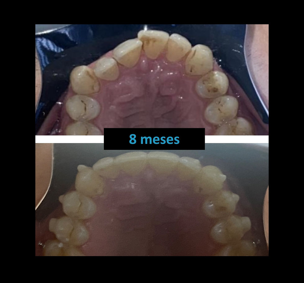 final 8 meses 2