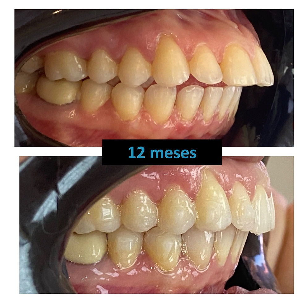 final 12 meses 2