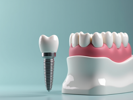 Affordable Dental Implant Options: Your Guide to Restoring Your Smile