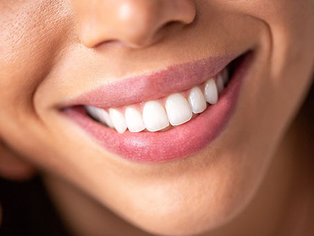 Whitening Tips for Sensitive Teeth: A Gentle Approach to a Brighter Smile