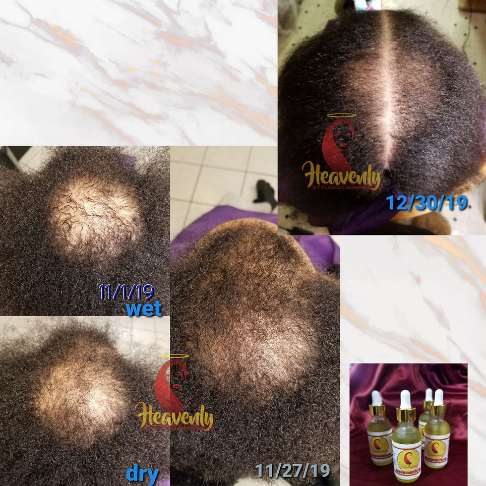 Thumbnail: HSL Growth Serum