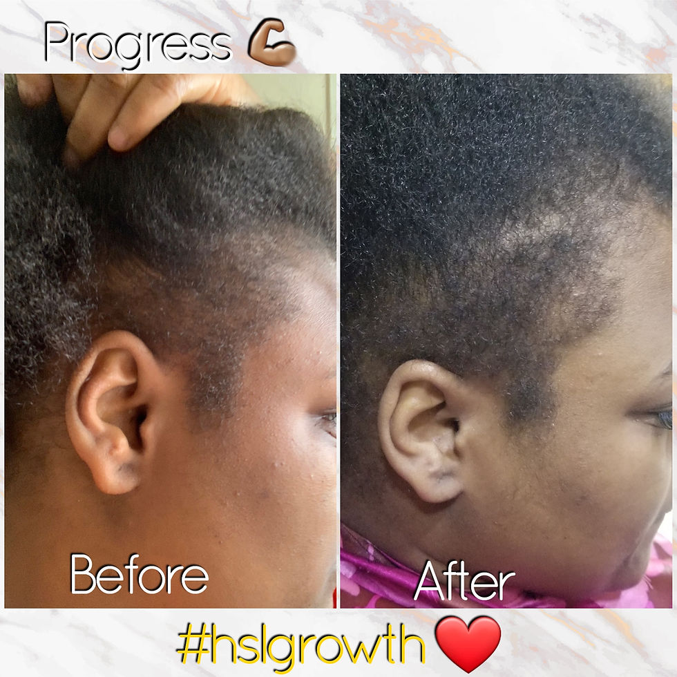 Thumbnail: HSL Growth Serum