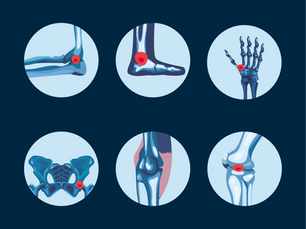 Rethinking Wearable Health in Rheumatoid Arthritis
