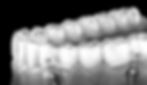 Orthodontic Aligner Bootcamp