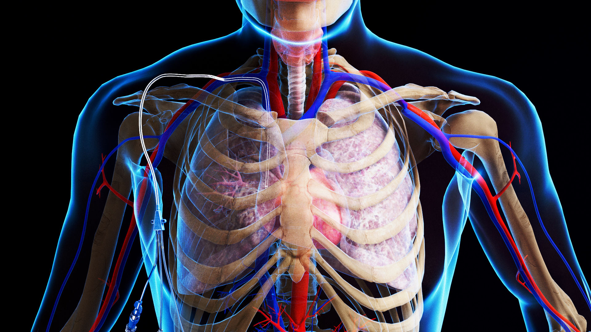3d render of tracher with X-ray Effect