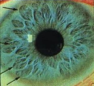 IRIDOLOGIA 3.jpg