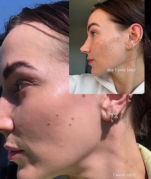 IPL Before & After.jpg
