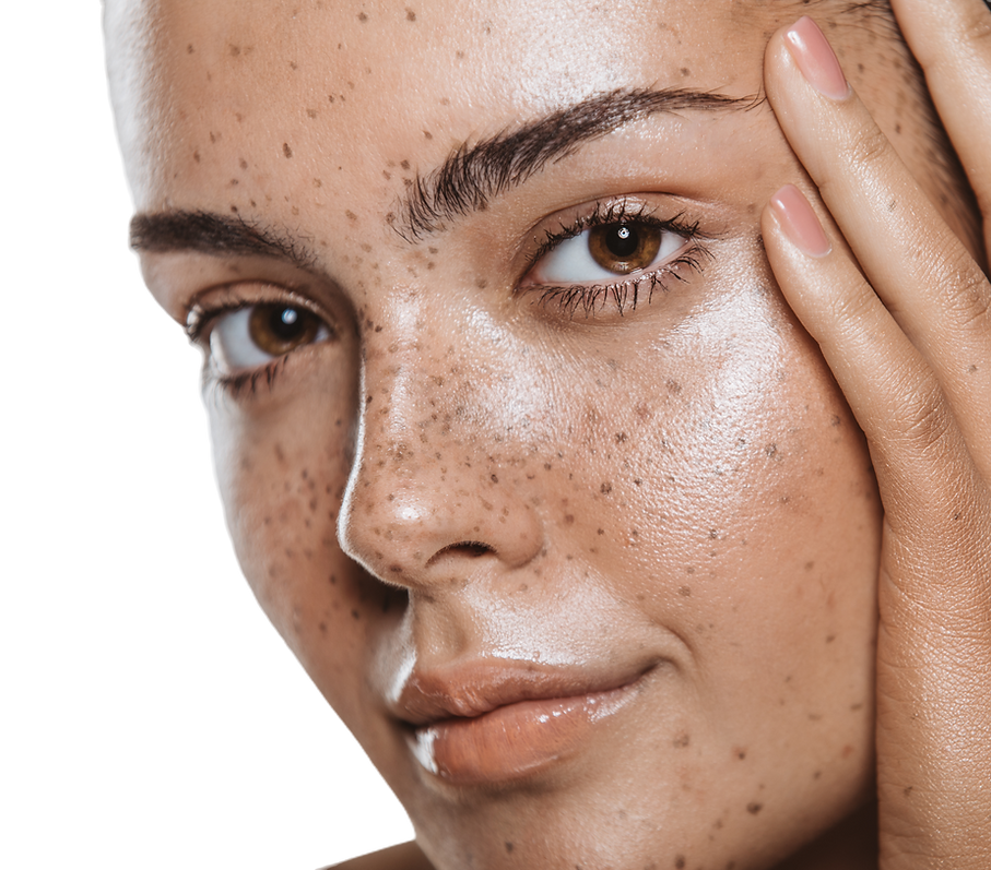 Close‑up of a woman’s face with natural freckles and soft, glowing skin
