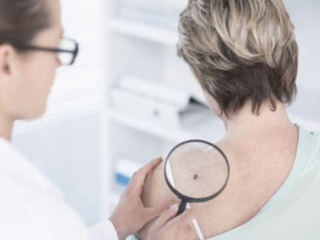melanoma and skin cancer awareness