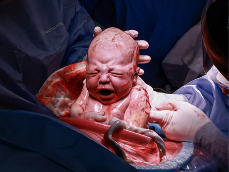How to have the Best Caesarean Ever!
