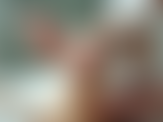 Gentle enzyme peel application at Miramont MedSpa