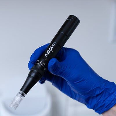 blue medical glove holding mdpen microneedling device for miramont medspa
