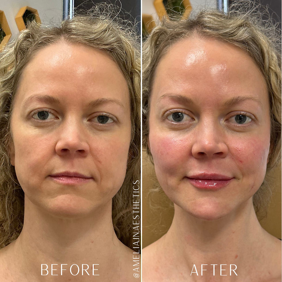 Side by side before and after images of facial balancing done by Amelia Dare Orr.