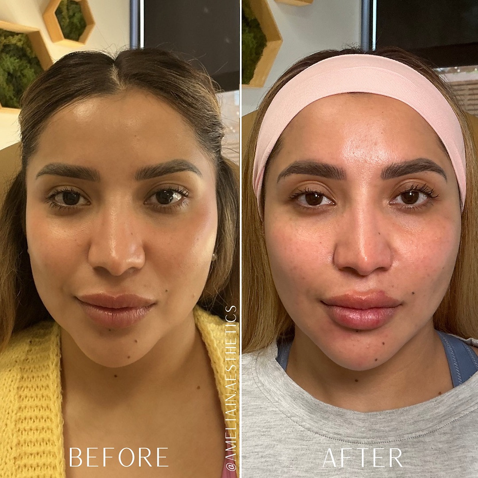 A woman smiling in side by side before and after flip treatments in Raleigh, NC.
