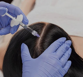 mesotherapie-cheveux-810x537_edited.jpg