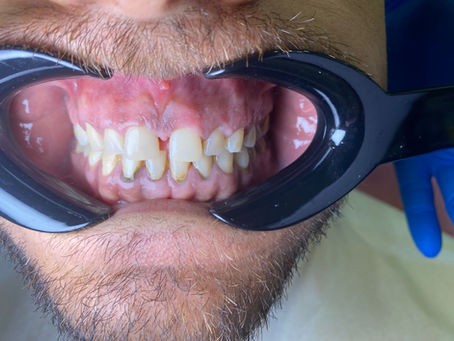 Sevdiğimiz insanların gülüşüne dokunmak bizim için çok daha özel ✨