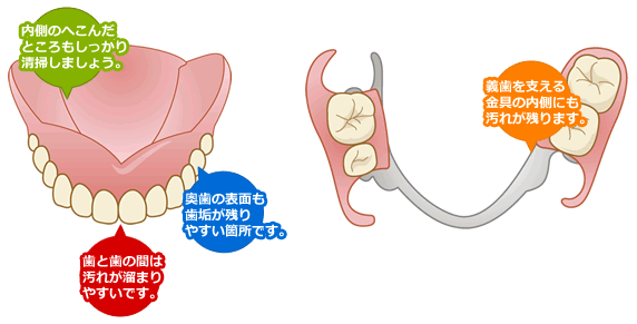 入れ歯清掃
