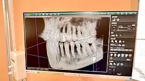 最新の歯科用CT断層撮影画像
