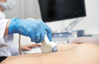 子宮・卵巣エコー検査