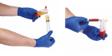 Non-Surgical Management of Knee Osteoarthritis