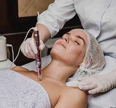 Genius RF Microneedling 4.jpg